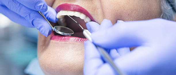Best Emergency Tooth Extraction in Meriden, CT